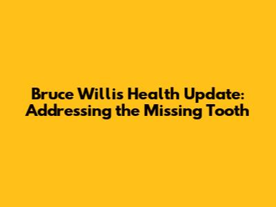 Bruce Willis Health Update: Addressing the Missing Tooth