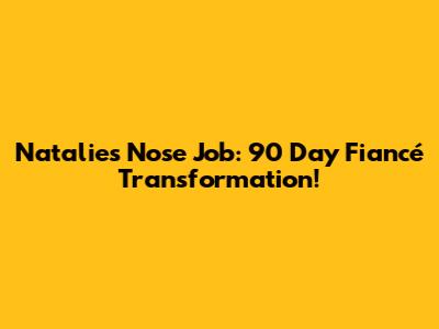 Natalie's Nose Job: 90 Day Fiancé Transformation!